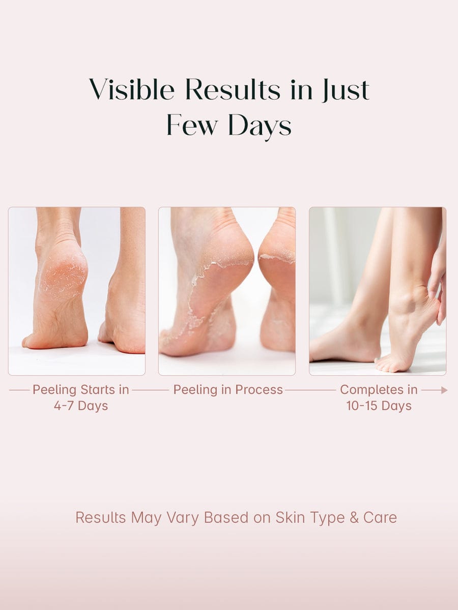 Exfoliating Foot Peel Mask (One pair)