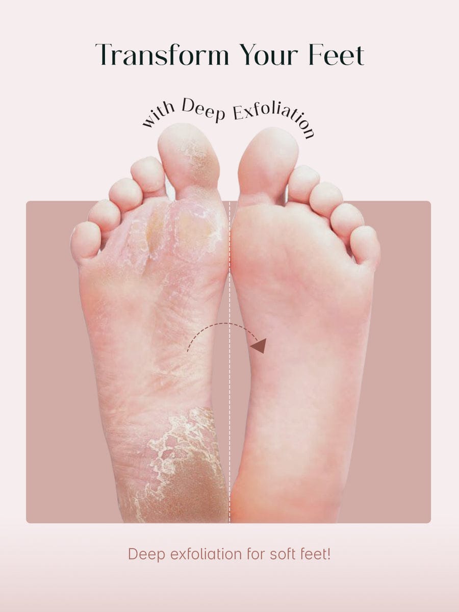 Exfoliating Foot Peel Mask (One pair)
