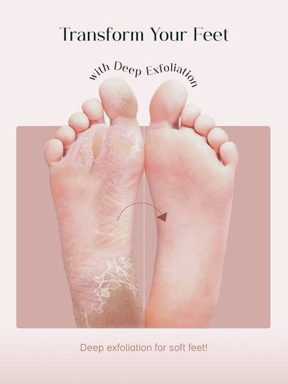 Exfoliating Foot Peel Mask (One pair)